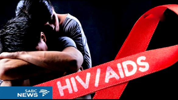hiv aids